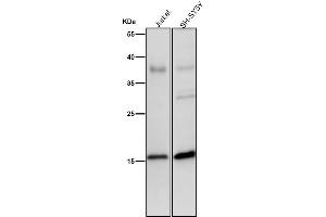 All lanes use the Antibody at 1:2K dilution for 1 hour at room temperature.