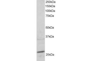 Image no. 1 for anti-RAB11A, Member RAS Oncogene Family (RAB11A) (C-Term) antibody (ABIN374252) (RAB11A Antikörper  (C-Term))