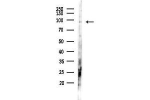 anti-Cancer Antigen 1 (CAGE1) (C-Term) antibody