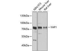 Western blot analysis of extracts of various cell lines, using Y antibody (ABIN6132789, ABIN6150317, ABIN6150322 and ABIN6215136) at 1:1000 dilution. (YAP1 Antikörper  (AA 155-504))