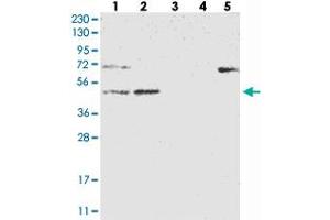 Western blot analysis of Lane 1: RT-4, Lane 2: U-251 MG, Lane 3: Human Plasma, Lane 4: Liver, Lane 5: Tonsil with NT5DC1 polyclonal antibody . (NT5DC1 Antikörper)