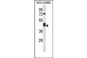 Western blot analysis of IDH3G Antibody (C-term) in NCI-H460 cell line lysates (35ug/lane). (IDH3G Antikörper  (C-Term))