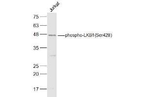 Jurkat lysates probed with LKB1(Ser428) Polyclonal Antibody, Unconjugated  at 1:500 dilution and 4˚C overnight incubation. (LKB1 Antikörper  (pSer428))