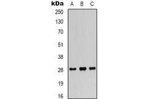 Western blot analysis of FGF18 expression in SW480 (A), SKOV3 (B), mouse heart (C) whole cell lysates.