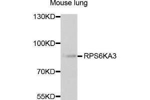 Western blot analysis of extracts of mouse lung, using RPS6KA3 antibody (ABIN5973157) at 1/1000 dilution. (RPS6KA3 Antikörper)