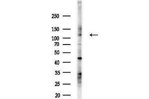 anti-Slingshot Homolog 1 (SSH1) (C-Term) antibody