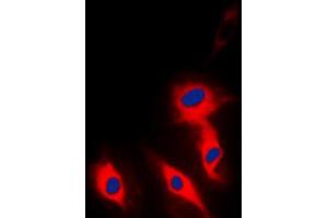 Immunofluorescent analysis of Ephrin A5 staining in Hela cells. (Ephrin A5 Antikörper  (Center))