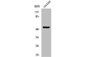 Western Blot analysis of COLO205 cells using Melanopsin Polyclonal Antibody (OPN4 Antikörper  (C-Term))