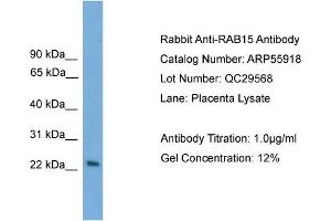WB Suggested Anti-RAB15  Antibody Titration: 0. (RAB15 Antikörper  (Middle Region))