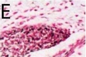 Immunohistochemistry (Paraffin-embedded Sections) (IHC (p)) image for anti-Microphthalmia-Associated Transcription Factor (MITF) (AA 351-450) antibody (ABIN676373)