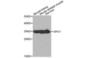 Western blot analysis of extracts of various cell lines, using GPD1 antibody (ABIN5973343) at 1/1000 dilution. (GPD1 Antikörper)