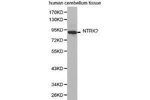 Western Blotting (WB) image for anti-Neurotrophic Tyrosine Kinase, Receptor, Type 2 (NTRK2) (AA 32-282) antibody (ABIN6219292) (TRKB Antikörper  (AA 32-282))
