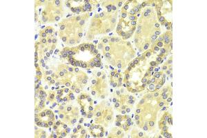 Immunohistochemistry of paraffin-embedded human kidney using MAP2K2 antibody. (MEK2 Antikörper)