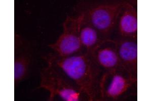 Immunofluorescence staining of methanol-fixed MCF cells using Phospho-ESR1-S118 antibody. (Estrogen Receptor alpha Antikörper  (pSer118))