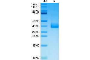 Cynomolgus PRLR on Tris-Bis PAGE under reduced condition. (Prolactin Receptor Protein (PRLR) (AA 25-236) (His tag))