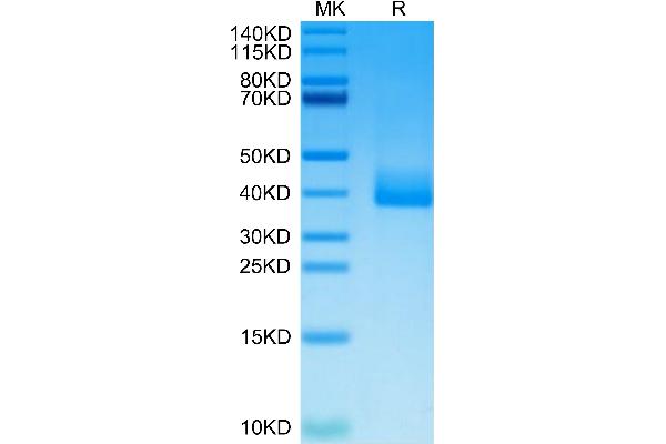 Prolactin Receptor Protein (PRLR) (AA 25-236) (His tag)
