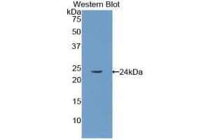 Detection of Recombinant RBP4, Human using Polyclonal Antibody to Retinol Binding Protein 4 (RBP4) (RBP4 Antikörper)