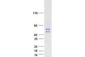 Western Blotting (WB) image for Matrix Metallopeptidase 1 (Interstitial Collagenase) (MMP1) (Transcript Variant 1) protein (Myc-DYKDDDDK Tag) (ABIN2726134)