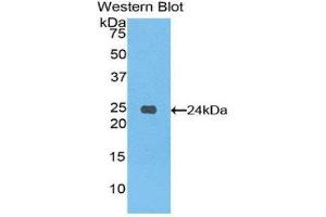 Western Blotting (WB) image for anti-Spondin 1 (SPON1) (AA 608-802) antibody (ABIN1860615) (SPON1 Antikörper  (AA 608-802))