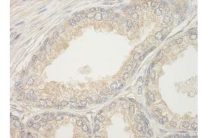 Immunohistochemistry (IHC) image for anti-BCL2-Associated Agonist of Cell Death (BAD) (AA 1-50) antibody (ABIN7448932) (BAD Antikörper  (AA 1-50))