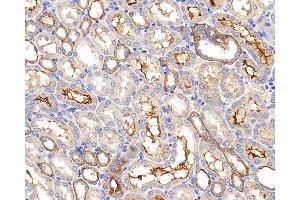 Immunohistochemistry (Paraffin-embedded Sections) (IHC (p)) image for anti-Chemokine (C-X-C Motif) Receptor 7 (CXCR7) antibody (ABIN7249546)