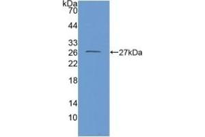 Detection of Recombinant GDH, Mouse using Polyclonal Antibody to Glutamate Dehydrogenase 1 (GLUD1) (GLUD1 Antikörper  (AA 65-273))