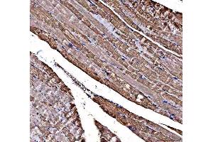 IHC analysis of DOK7 using anti-DOK7 antibody (ABIN6719428). (DOK7 Antikörper)