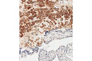 Immunohistochemistry (Paraffin-embedded Sections) (IHC (p)) image for anti-HLA Class I Histocompatibility Antigen, alpha Chain G (HLAG) (AA 62-89) antibody (ABIN652888)