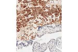 Immunohistochemical analysis of paraffin-embedded Human placenta tissue using (ABIN652888 and ABIN2842575) performed on the Leica® BOND RXm.