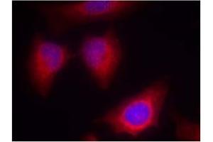 Image no. 2 for anti-Protein Kinase C, theta (PRKCQ) (AA 674-678) antibody (ABIN197566) (PKC theta Antikörper  (AA 674-678))