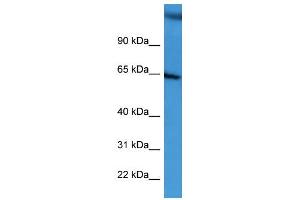 WB Suggested Anti-BCAM Antibody Titration: 0. (BCAM Antikörper  (C-Term))
