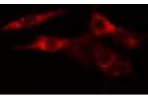 ABIN6277566 staining HeLa cells by IF/ICC. (EEF2K Antikörper  (Internal Region))