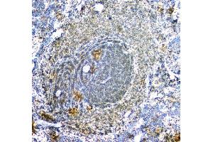 IHC analysis of ARA9/AIP using anti-ARA9/AIP antibody (ABIN6719423).