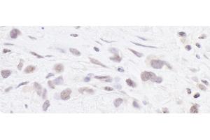 Immunohistochemistry (IHC) image for anti-Polymerase (RNA) III (DNA Directed) Polypeptide B (POLR3B) (AA 1083-1133) antibody (ABIN7453642) (POLR3B Antikörper  (AA 1083-1133))
