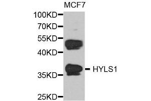Western blot analysis of extract of various cells, using HYLS1 antibody. (HYLS1 Antikörper)