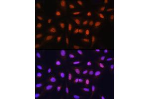 Immunofluorescence analysis of U-2 OS cells using GTF2H1 Rabbit pAb (ABIN6131728, ABIN6141498, ABIN6141499 and ABIN6222557) at dilution of 1:100 (40x lens). (GTF2H1 Antikörper  (AA 1-425))