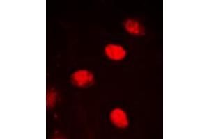 Immunofluorescent analysis of NPAS4 staining in HEK293T cells. (NPAS4 Antikörper  (C-Term))