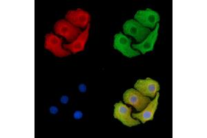 ABIN7095394 and ABIN7099451 staining Hela cells by IF/ICC.