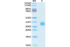 ROR1 Protein (AA 39-151) (His tag)