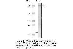 Image no. 1 for anti-Tyrosine Kinase 2 (TYK2) antibody (ABIN232114) (TYK2 Antikörper)