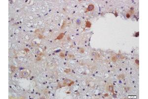 Formalin-fixed and paraffin embedded rat brain labeled with Rabbit Anti-VAT Polyclonal Antibody, Unconjugated (ABIN735113) at 1:200 followed by conjugation to the secondary antibody and DAB staining (SLC18A3 Antikörper  (AA 201-300))