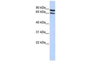 Image no. 1 for anti-Solute Carrier Family 6 (Neutral Amino Acid Transporter), Member 15 (SLC6A15) (AA 180-229) antibody (ABIN6740852) (SLC6A15 Antikörper  (AA 180-229))