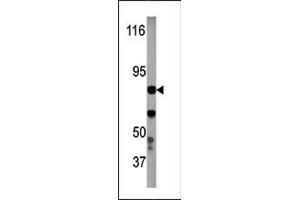 The anti-Phospho-IKKb- Pab (ABIN389574 and ABIN2839600) is used in Western blot to detect Phospho-IKKb- in Y79 tissue lysate (IKBKB Antikörper  (pTyr199))