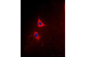 Immunofluorescent analysis of BCLX (pT47) staining in Hela cells. (BCL2L1 Antikörper  (pSer47))