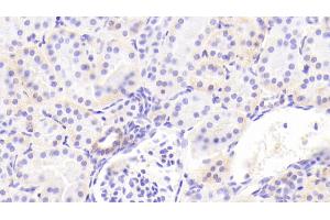 Detection of ITGa2 in Human Kidney Tissue using Polyclonal Antibody to Integrin Alpha 2 (ITGa2) (ITGA2 Antikörper  (AA 170-361))