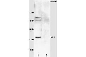 L1 rat brain lysates L2 rat kidney lysates probed with Anti IL-2R gamma/CD132 Polyclonal Antibody, Unconjugated (ABIN685432) at 1:200 overnight at 4 °C.