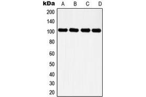 Western blot analysis of Histone Deacetylase 7 expression in HeLa (A), NIH3T3 (B), PC12 (C), rat kidney (D) whole cell lysates. (HDAC7 Antikörper  (C-Term))