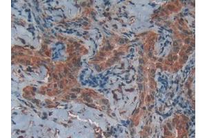 Used in DAB staining on fromalin fixed paraffin-embedded Liver tissue (CD40 Ligand Antikörper  (AA 180-261))