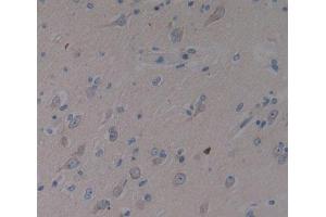 Used in DAB staining on fromalin fixed paraffin- embedded brain tissue (SMS Antikörper  (AA 2-366))