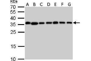 WB Image PPA1 antibody detects PPA1 protein by Western blot analysis. (Pyrophosphatase (Inorganic) 1 (PPA1) Antikörper)